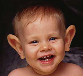 Chlapček s veľkými odstávajúcimi ušami